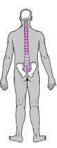 Hérnia discal vertebras