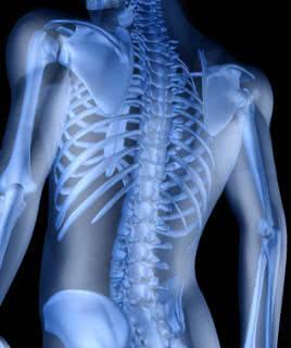 coluna vertebral e osteoporose
